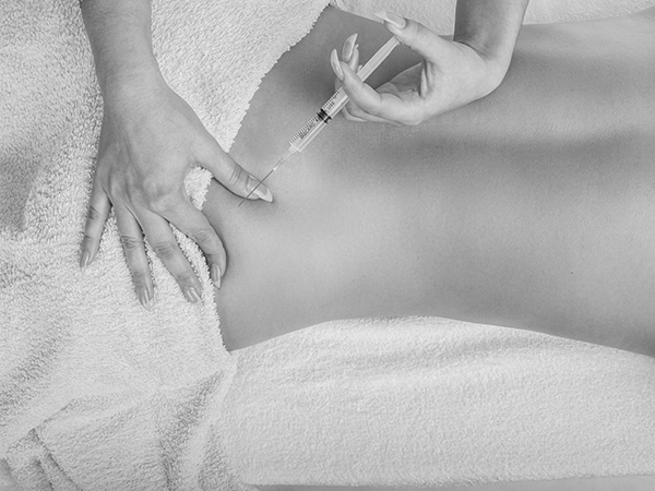 Lipolizja iniekcyjna
